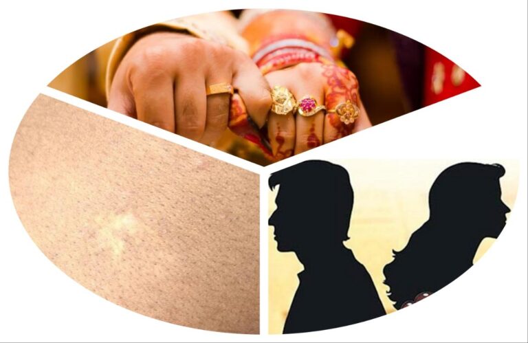 अवांतर, मराठीकथा, मराठीलेखक, मराठीवाचन, मराठीसाहित्य, पांडू लग्न, पांडू सुरेखा, पांढरा डाग, सुरेखाचा घटस्फोट, रमेश सुरेखा, सुरेखाचा पुनर्विवाह