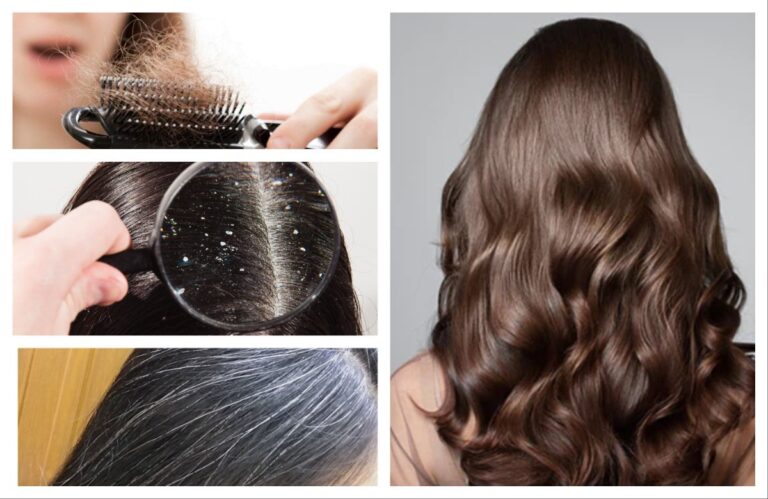 अवांतर, मराठीआर्टिकल, केसांची निगा, हेअर केअर, केस गळणे, केसात कोंडा, चाई, पांढरे केस, शॅम्पू,