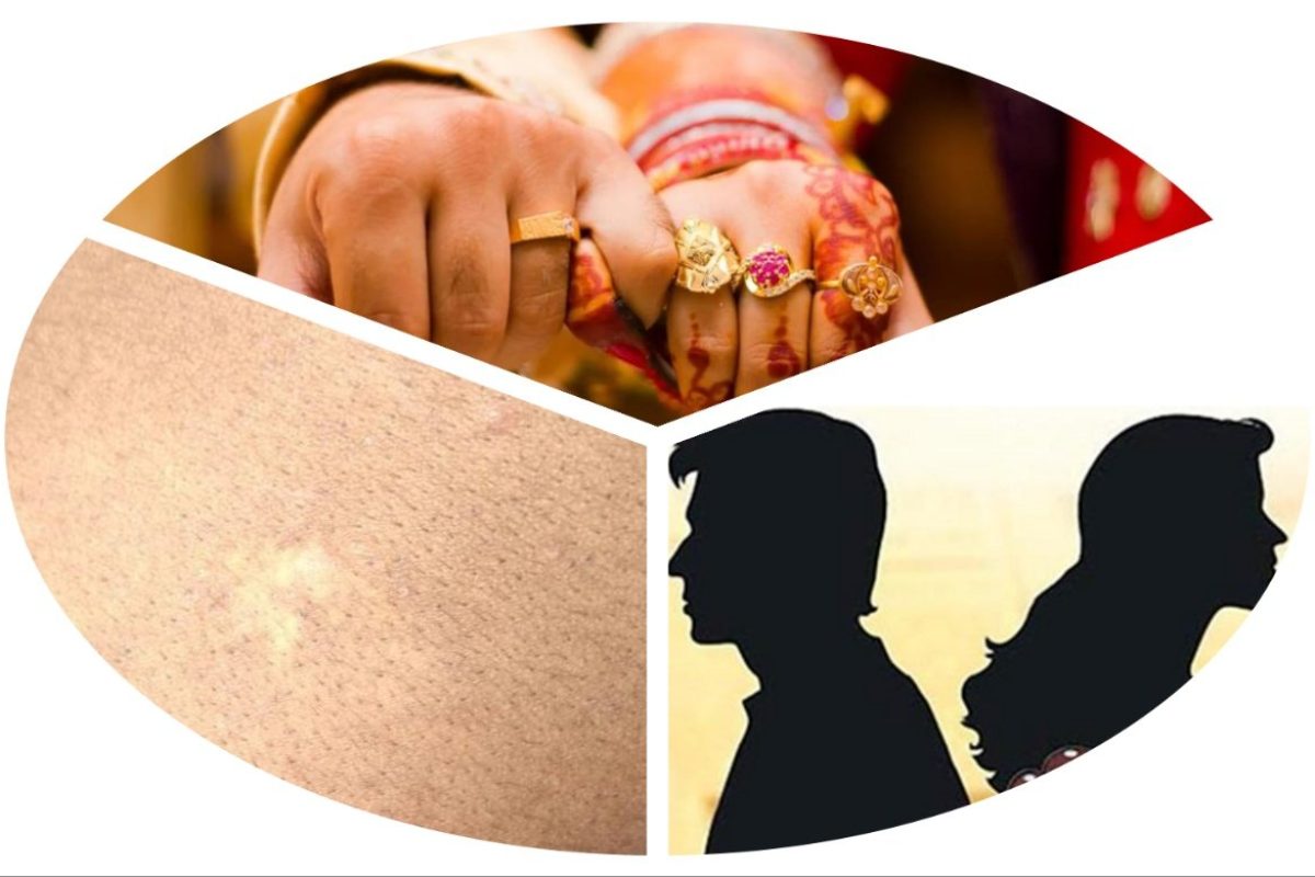 अवांतर, मराठीकथा, मराठीलेखक, मराठीवाचन, मराठीसाहित्य, पांडू लग्न, पांडू सुरेखा, पांढरा डाग, सुरेखाचा घटस्फोट, रमेश सुरेखा, सुरेखाचा पुनर्विवाह