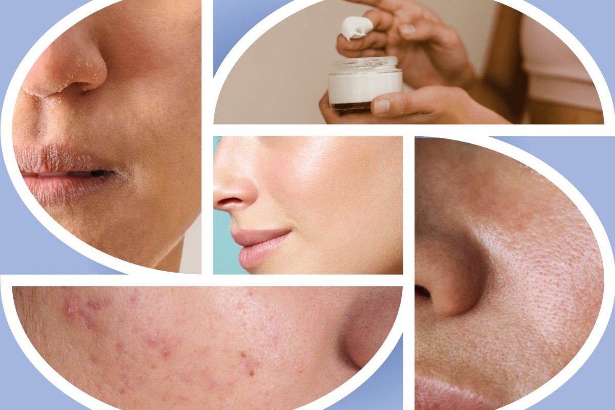 आणि, अवांतर, मराठीकथा, मराठीलेख, मराठीसाहित्य, मराठीआर्टिकल, त्वचा, त्वचेचीनिगा, कोरडीत्वचा, चुकीचीउत्पादने, Skin, Skincare, DrySkin, WrongProducts