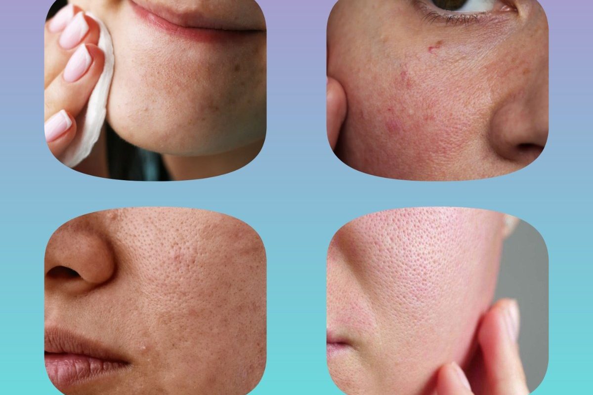 अवांतर, मराठीकथा, मराठीलेखक, मराठीसाहित्य, मराठीआर्टिकल, combinationskin, SkinProducts, Cleansing, Toning, Moisturizing, कोरडीत्वचा, क्लिनझिंग, टोनिंग, मॉश्चरायझिंग, मिश्रत्वचा, SensitivSkin,