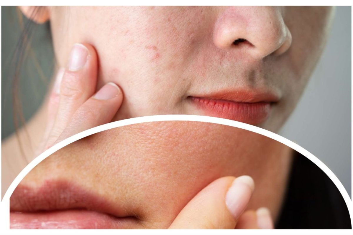 त्वचेची, अवांतर, मराठीकथा, मराठीलेखक, मराठीसाहित्य, Skin, DrySkin, OilySkin, कोरडीत्वचा, तेलकटत्वचा